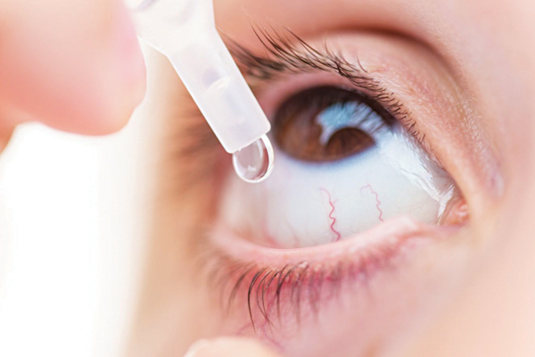  Bệnh nhân nên sử dụng thuốc nhỏ nước mắt nhân tạo (lỏng hoặc gel) ngày